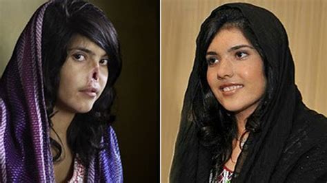 el presente norteamericano de la joven afgana víctima del talibán