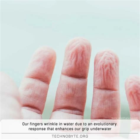 why do our fingers wrinkle underwater or after a long shower