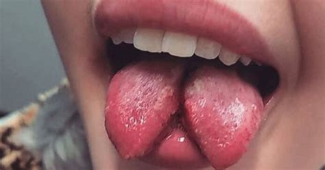 scientists warn of the risks of tongue splitting trend that sees