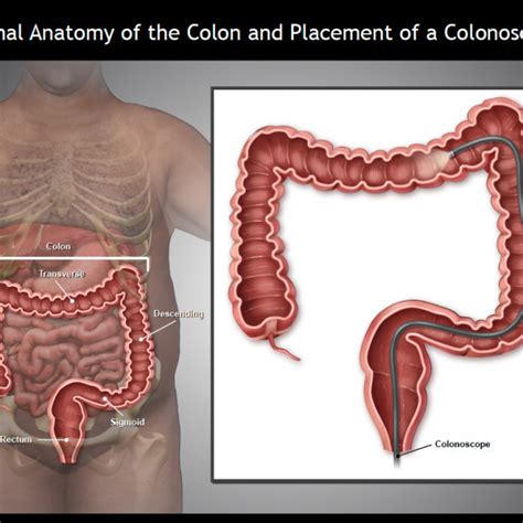 heavy male normal anatomy of the colon and placement of a