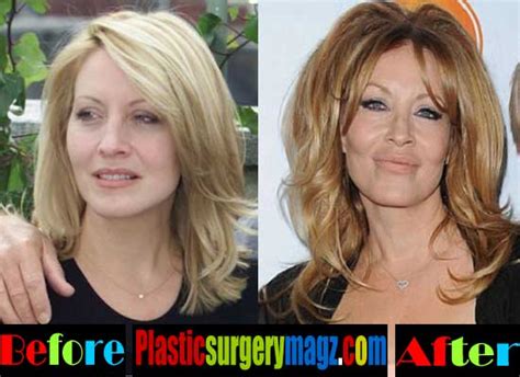 Linda Kozlowski Plastic Surgery Before And After Plastic