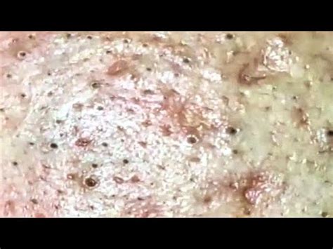 enjoy everyday  beauty skin spa satisfying relaxing video  youtube