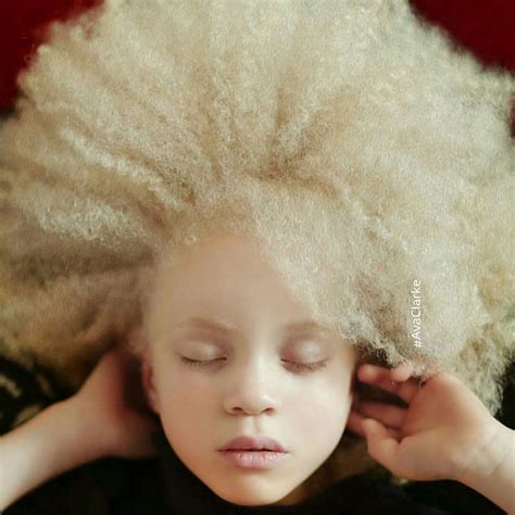 unique beauty  albino people