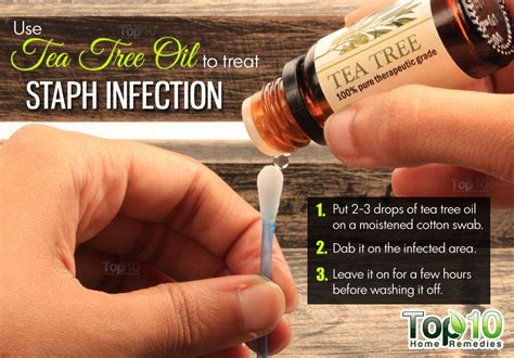 home remedies  staph infection top  home remedies