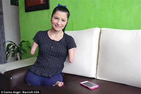 Woman Born Without Arms Or Legs Creates The Most Beautiful