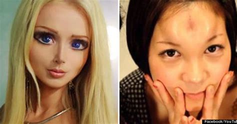unusual beauty crazes from human barbie to bagel head implants pictures