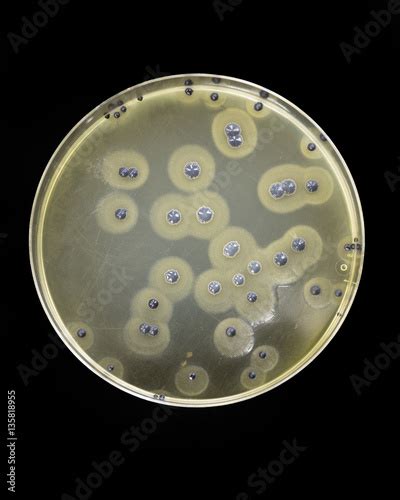 Staphylococcus Aureus Growing On Baird Parker Agar Showing Black
