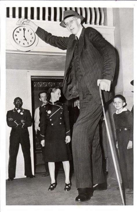 acromegaly gigantism  worlds tallest human hubpages