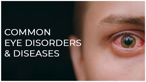 Common Eye Disorders And Diseases