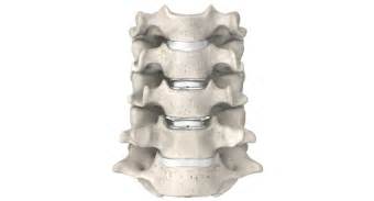 distinguished support  review  spinal orthopedic technologies covering  specialized