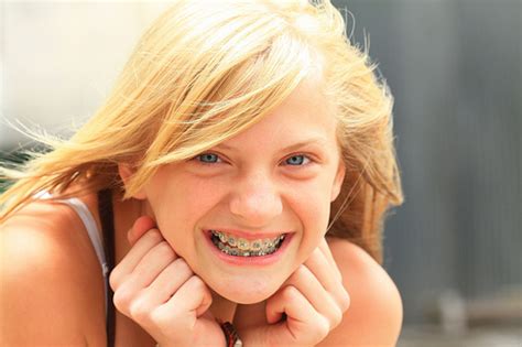 why i m making my daughter pay for her dental braces len penzo dot com