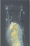 Image result for Brandtiella. Size: 120 x 185. Source: marinespecies.org