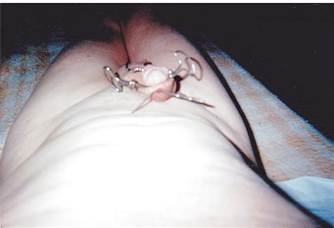 genital bondage and torture 17 pics xhamster