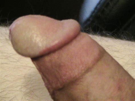 Circumcised Penis Cock Head Closeup 47 Pics Xhamster