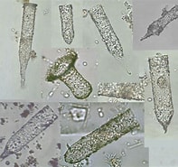 Image result for "tintinnopsis Kofoidi". Size: 197 x 185. Source: protist.i.hosei.ac.jp
