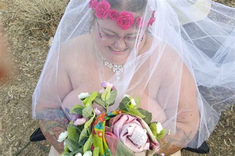 Woman Gets Married Naked After Nearly Dying From Flesh
