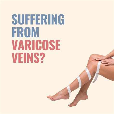 Do You Suffer From Varicose Varicose Veins Care Center Facebook