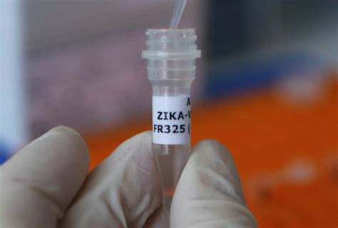 Zika Virus Might Also Spread Via Oral Sex French