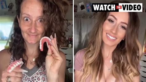 Toothless Mum Shows Off Incredible False Teeth Transformation Photos