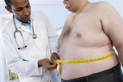 doctors inform patients they re obese but offer few solutions health