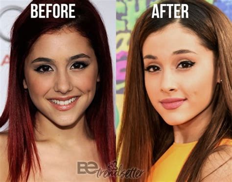 ariana grande plastic surgery revealed then and now