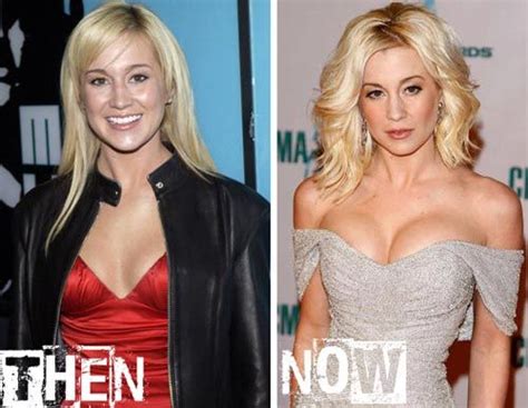 kellie pickler plastic surgery before and after plastic surgery pinterest kellie pickler
