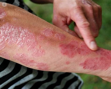 skin rash top doctors