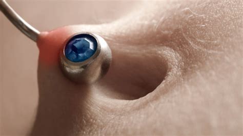What To Do With An Infected Belly Button Piercing