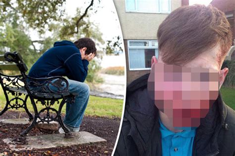 graphic pics bullied schoolboy left  horrific face injuries