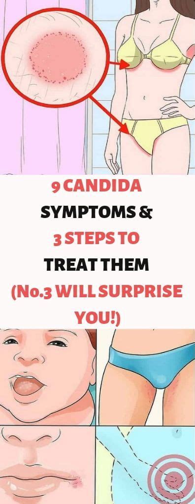 9 Candida Symptoms And 3 Steps To Treat Them Do You Ever Experience Any