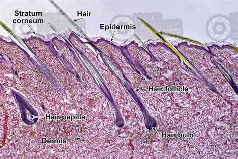 man scalp vertical section  scalp mammals integumentary