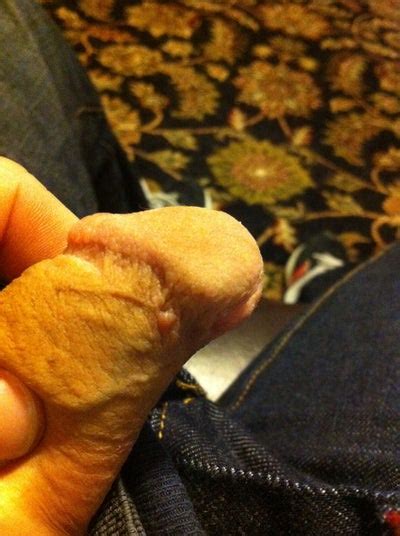 bump on tip of penis sex nude celeb