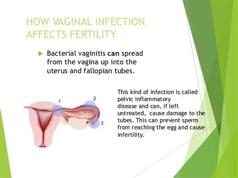 Vaginal Infection And Infertility