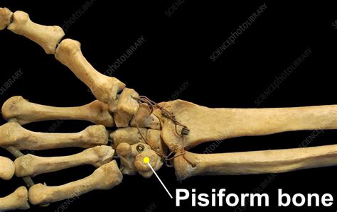 pisiform bone stock image  science photo library