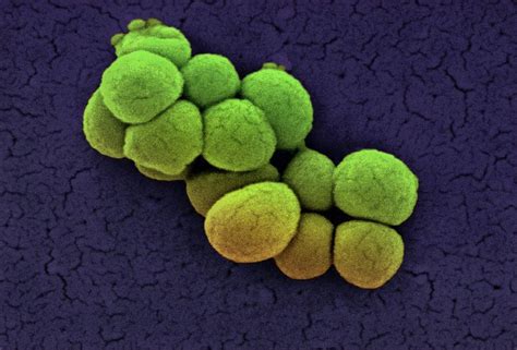 Micrococcus Luteus Bacteria Photograph By Ami Images