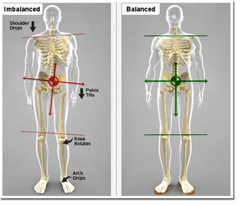 Leg Length Discrepancies Leg Length Inequality And Back Hip And Knee