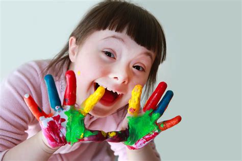 What Causes Down Syndrome Facial Features What To Know
