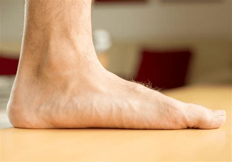 pronation  flat feet foot mechanics