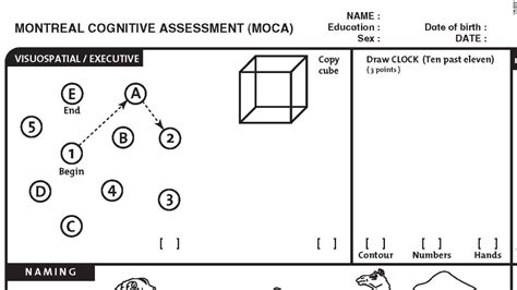 montreal cognitive assessment what to know cnn