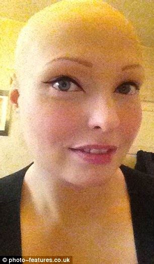 brenda finn left completely bald by alopecia on bully hell before £300