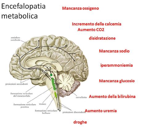 encefalopatia metabolica epub