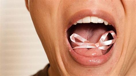 Holistic Tongue Tie Release Step By Step Program