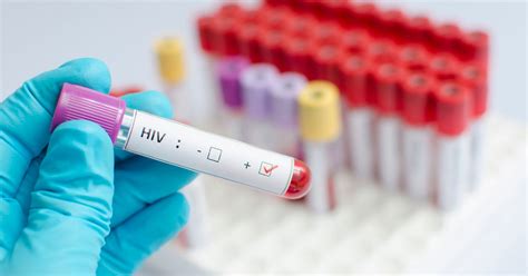 promising study reveals  hope   hiv cure huffpost