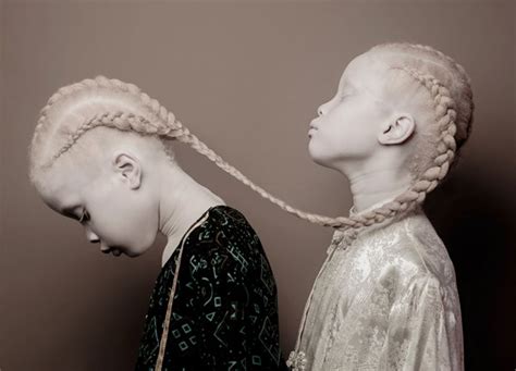 flores raras albino twins from brazil photography by vinicius terranova ego