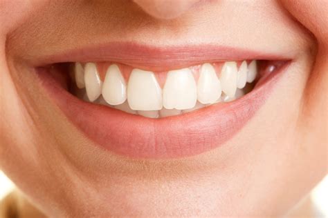 open mouth  perfect white teeth hancock village dental