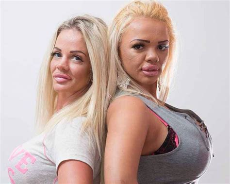 mom and daughter splurge 80 000 on surgery to look like their idol katie price wow amazing