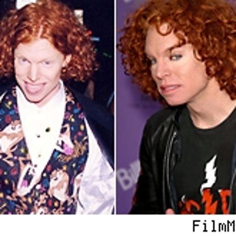 carrot top plastic surgery