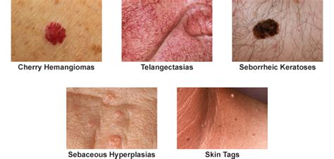 treatment  aging skin orlando associates  dermatology