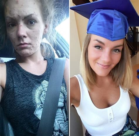 woman addicted to meth shared before and after photos showing her