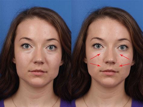 face morphed   plastic surgeon   shocked   results business insider